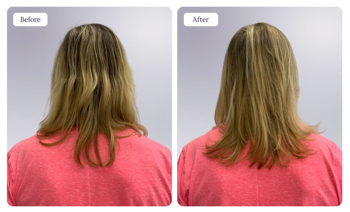 KER_B&A_Deb_Back