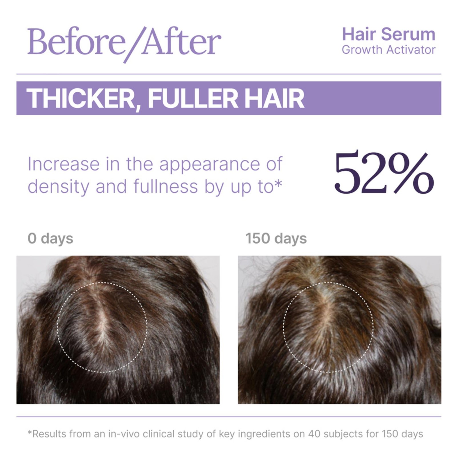 KQ_HairSerum_Infografics_V01-06-Photoroom